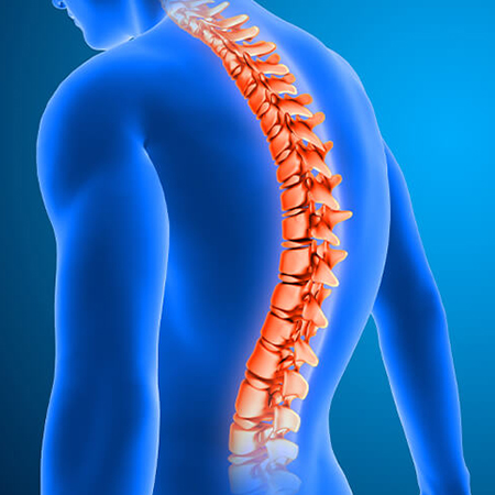 Türkiye’de Skolyoz Vakalarında Artış